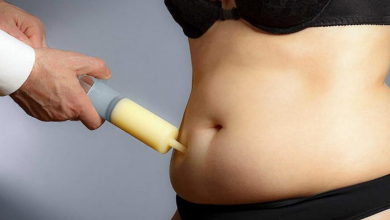 Liposuction Operasyonu Sonrası Kilo Verme Nasıl Olur?