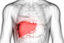 Karaciğer Yağlanması Nedir, Neden Olur?