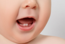 Bebeklerde Diş Çıkarma Belirtileri Nelerdir