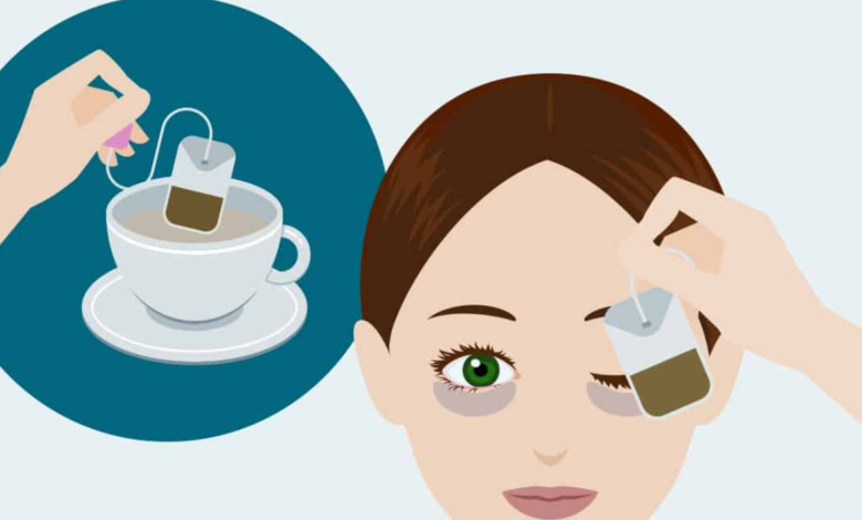 Göz Altı Morluklarına Karşı Doğal ve Kolay Bakım Önerileri